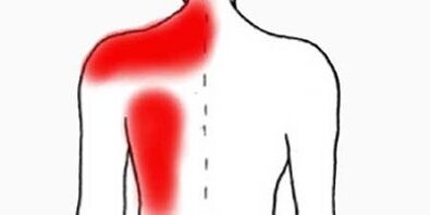 болка под лявата лопатка от гърба